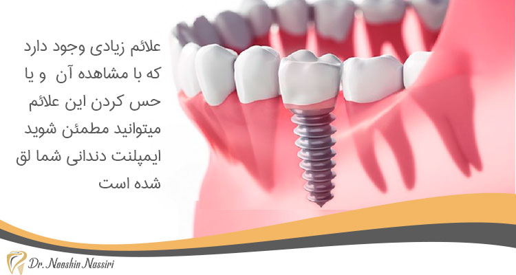 علائم لق شدن ایمپلنت دندان