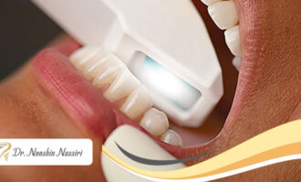 مراحل اسکن دیجیتال دندان و مزایای آن