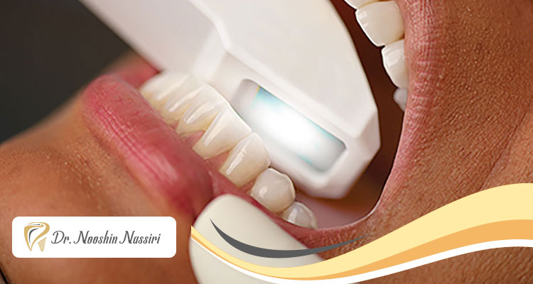 مراحل اسکن دیجیتال دندان و مزایای آن
