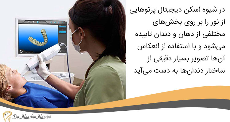 در اسکن دیجیتال دندان تصاویر دقیقی از ساختار دندان ها به دست می اید