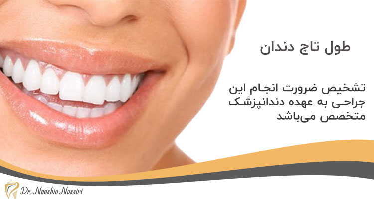 تشخیص انجام افزایش طول تاج دندان