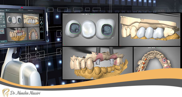 مراحل اسکن دیجیتال دندان