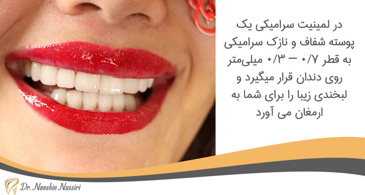 لمینت سرامیکی در دندانپزشکی زیبایی در کلینیک دکتر نوشین نصیری