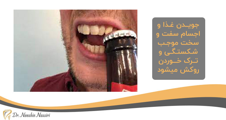 برداشتن روکش دندان در اثر شکستگی
