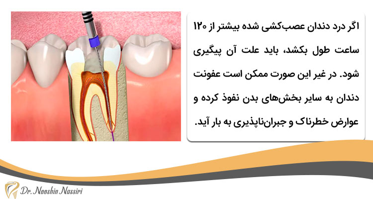 علت درد دندان عصب کشی شده