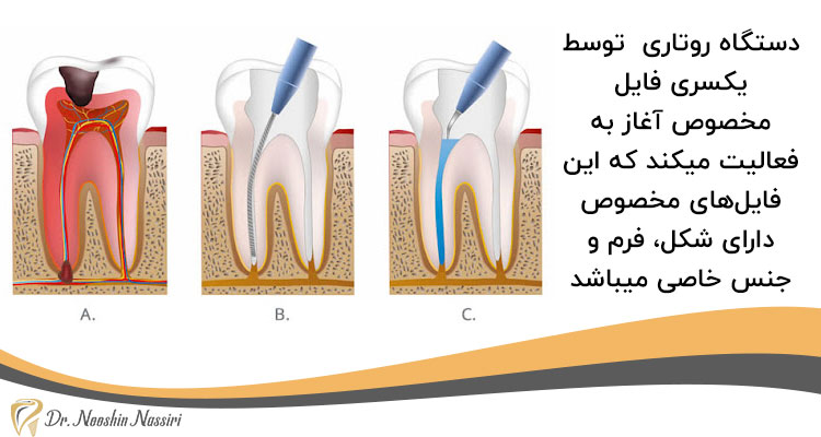 دستگاه روتاری دندانپزشکی چیست