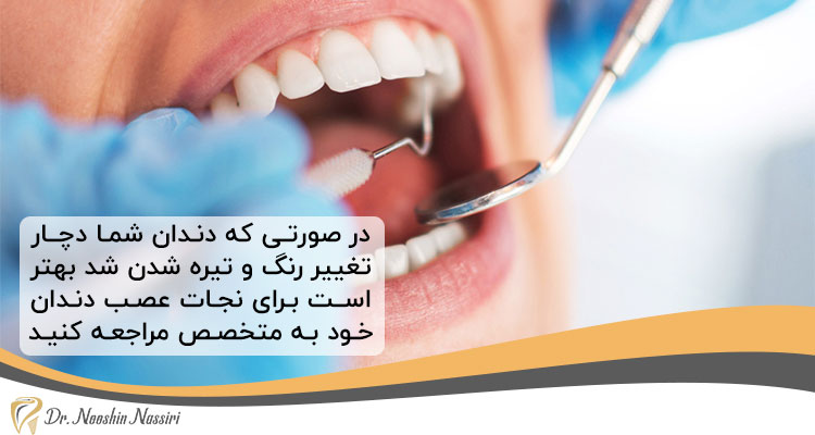 علائم پوسیدگی دندان برای درمان ریشه