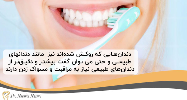 مراقبت از دندان ها برای افزایش عمر روکش دندان