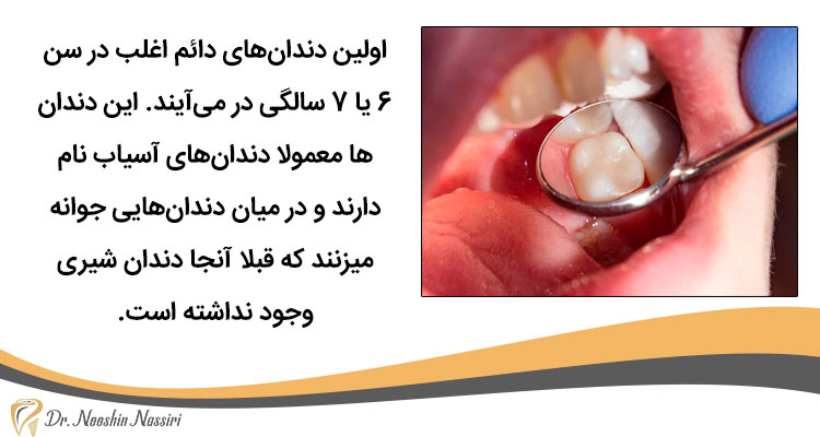 درآوردن دندان آسیاب در کودکان ۷ ساله