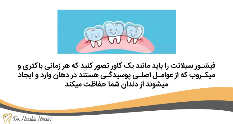 جلوگیری از پوسیدگی دندان با فیشور سیلانت