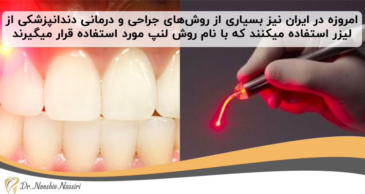 دندانپزشکی با لیزر در ایران