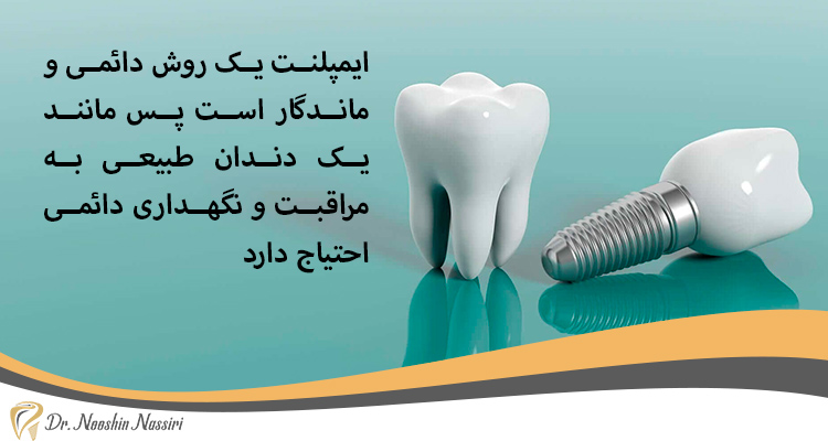 ایمپلنت دندان ماندگار و طبیعی
