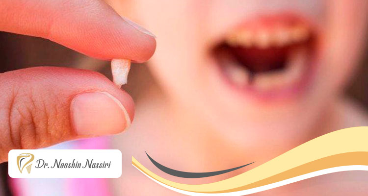 دندان شیری و نیاز به عصب کشی