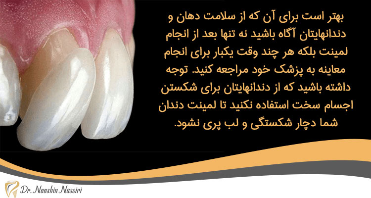 انتخاب شکل مناسب لمینت دندان