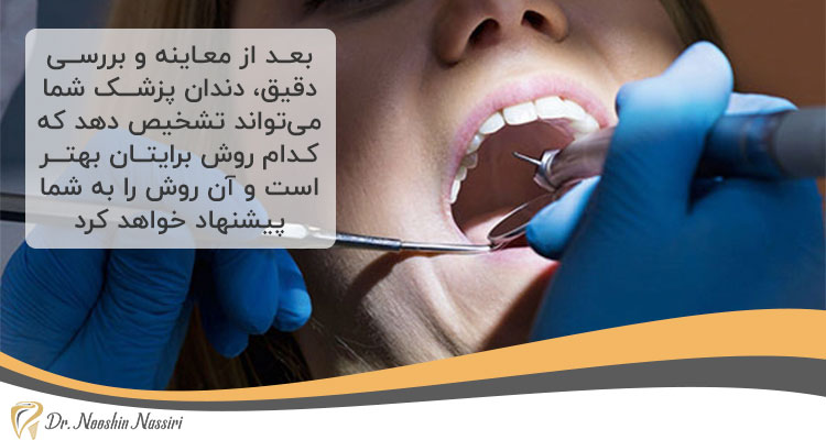 معاینه دندانپزشک و انتخاب بهترین نوع روکش دندان