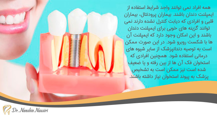 چه کسانی نمی توانند ایمپلنت دندان انجام دهند