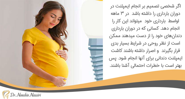 خطرات کاشت ایمپلنت در دوران بارداری