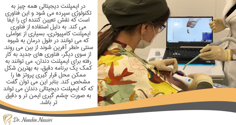 در ایمپلنت دیجیتالی همه چیز به تکنولوژی سپرده می شود