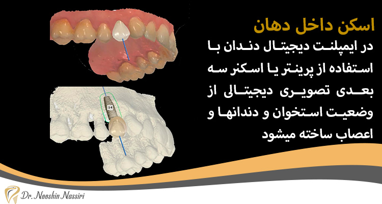 پرینتر سه بعدی و اسکن داخل دهان دکتر نصیری