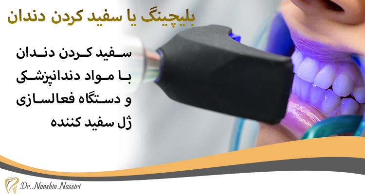 بلیچینگ یا سفید کردن دندان دکتر نوشین نصیری