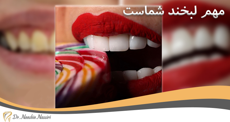 مهم لبخند شماست شعار کلینیک دکتر نوشین نصیری