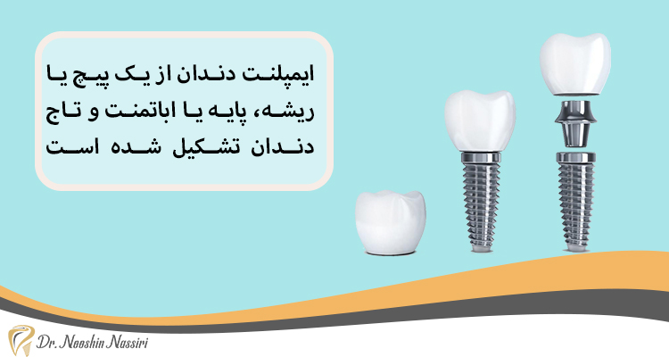 اجزای ایمپلنت دندان دکتر نصیری