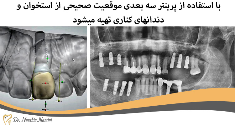 پرینتر سه بعدی دندانپرشکی دیجیتال