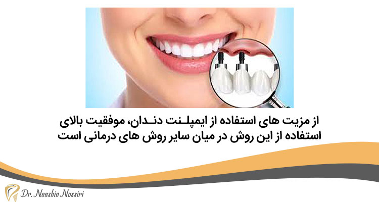 مزیت کاشت ایمپلنت دندان چیست