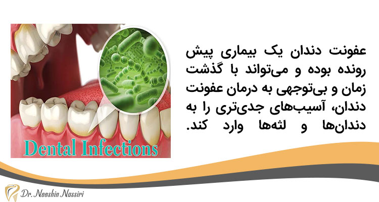 اهمیت درمان عفونت دندان