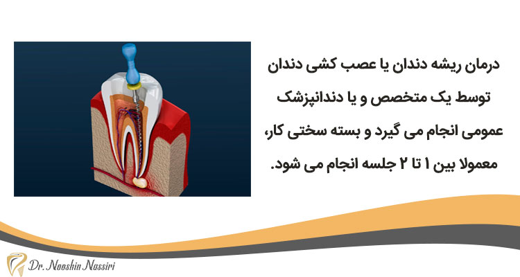 درمان ریشه دندان یا عصب کشی دندان