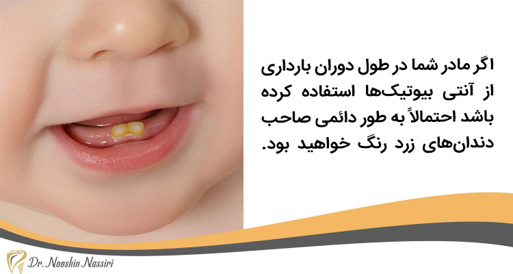 مصرف آنتی بیوتیک و زرد شدن دندانها