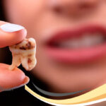 پوسیدگی دندان و روش درمان آن