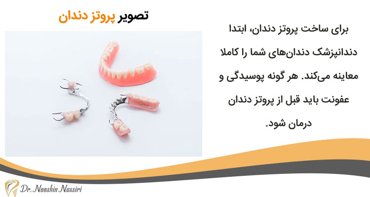 تصویر پروتز دندانی